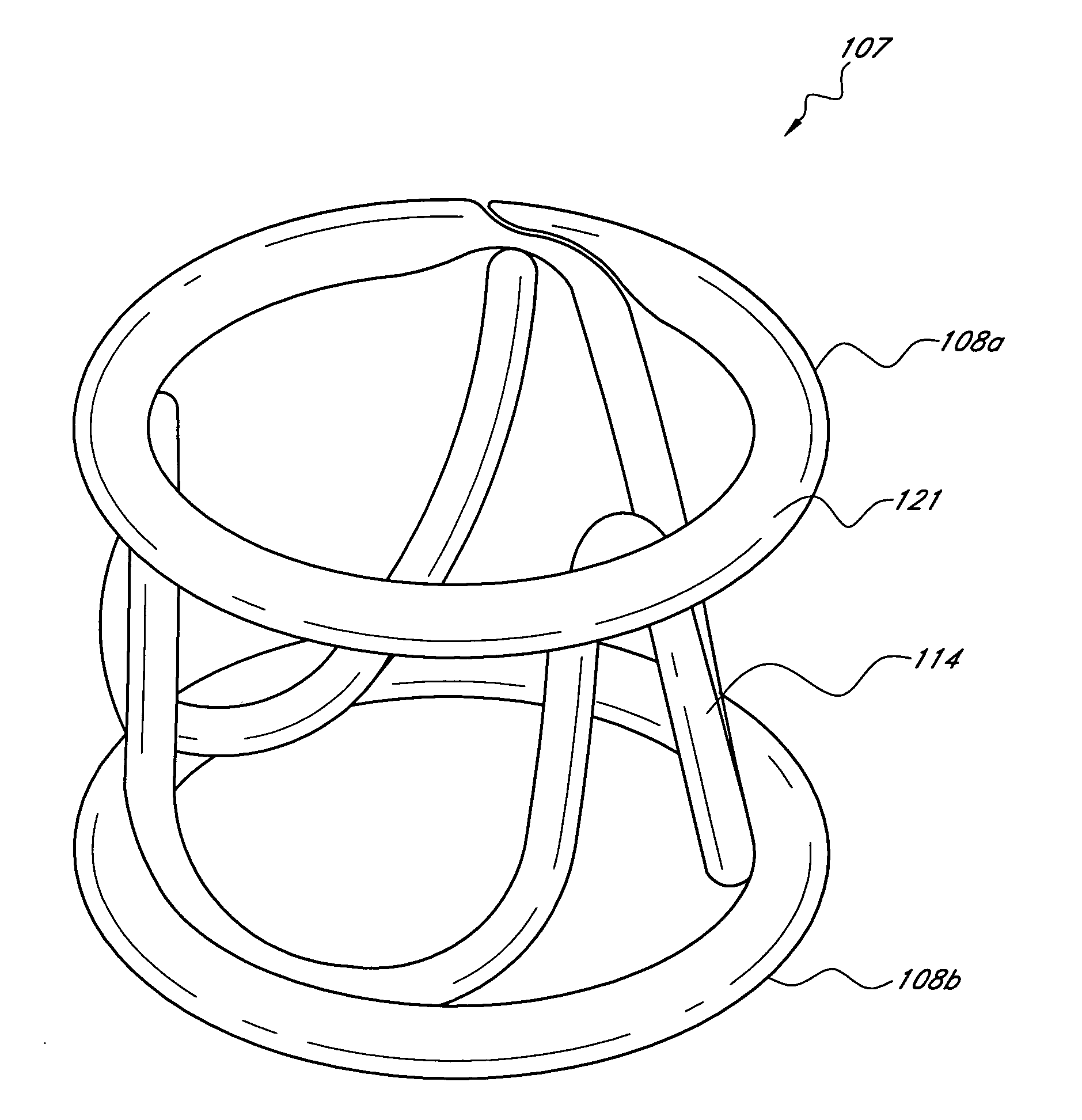 Nonstented temporary valve for cardiovascular therapy