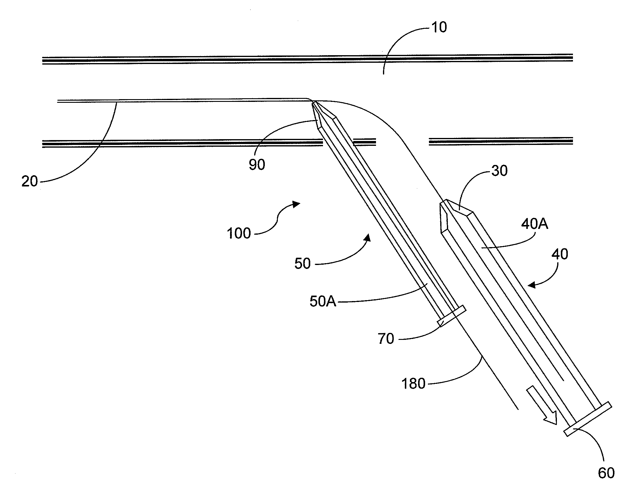 Apparatus and Associated Method for Facilitating Implantation of Leads of a Cardiac Pacemaker