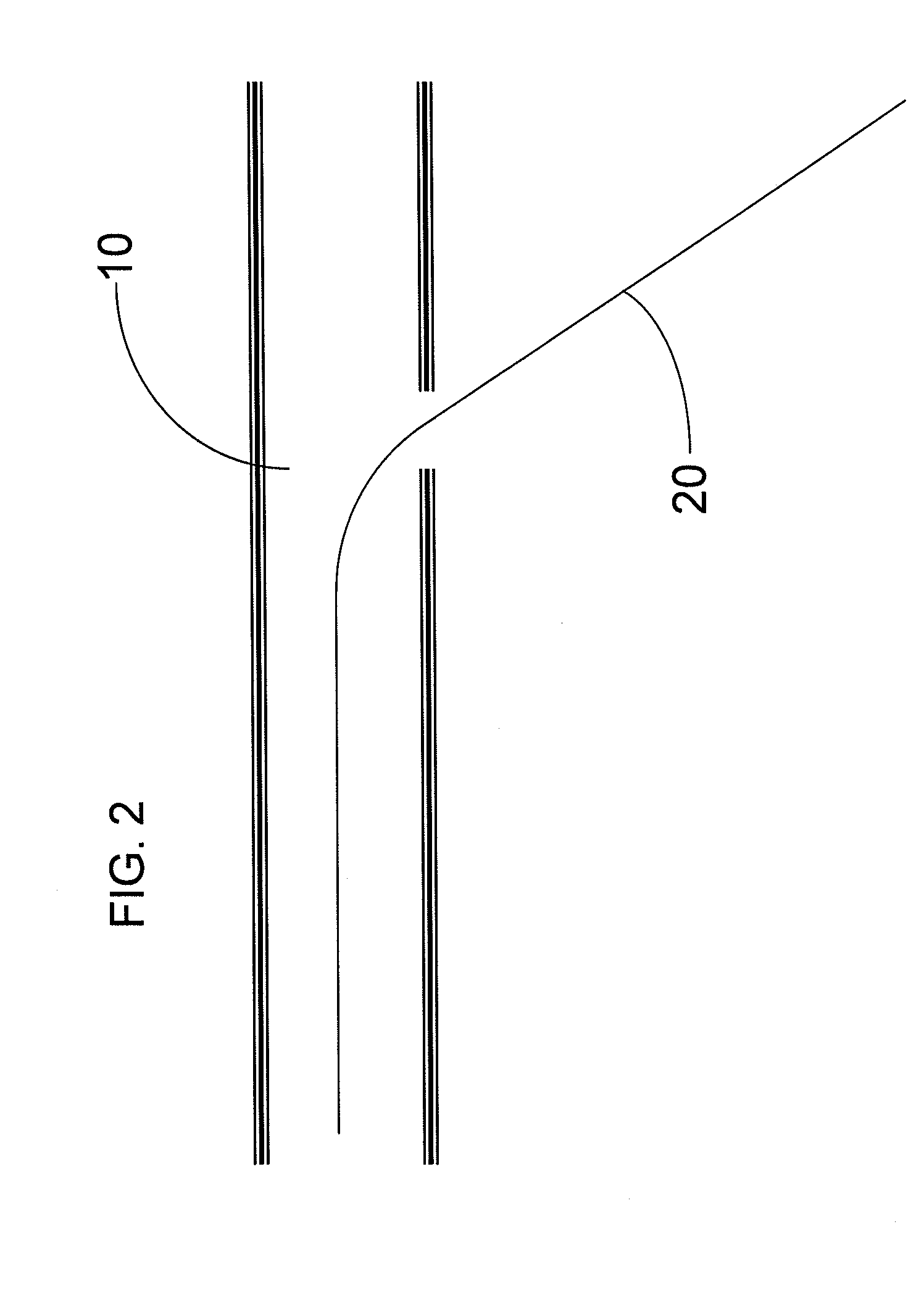 Apparatus and Associated Method for Facilitating Implantation of Leads of a Cardiac Pacemaker