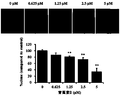 Effects of Artemisinin B on Inhibiting Migration and Invasion of A549 Cells