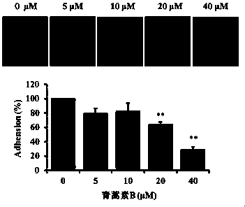 Effects of Artemisinin B on Inhibiting Migration and Invasion of A549 Cells