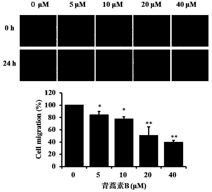 Effects of Artemisinin B on Inhibiting Migration and Invasion of A549 Cells