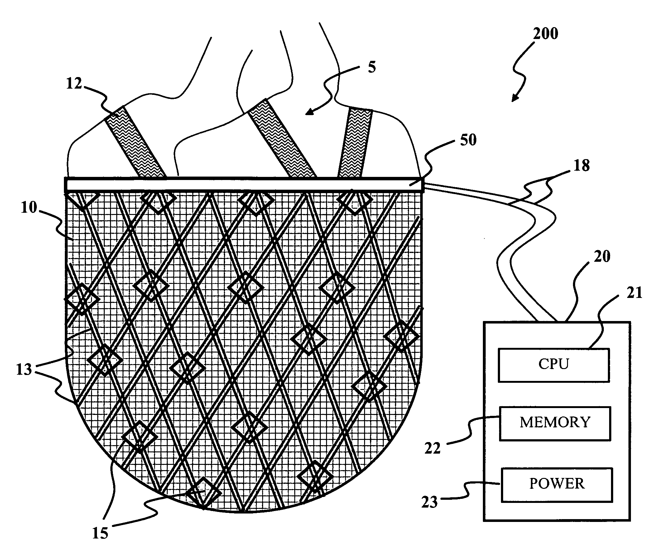 Electromechanical machine-based artificial muscles, bio-valves and related devices