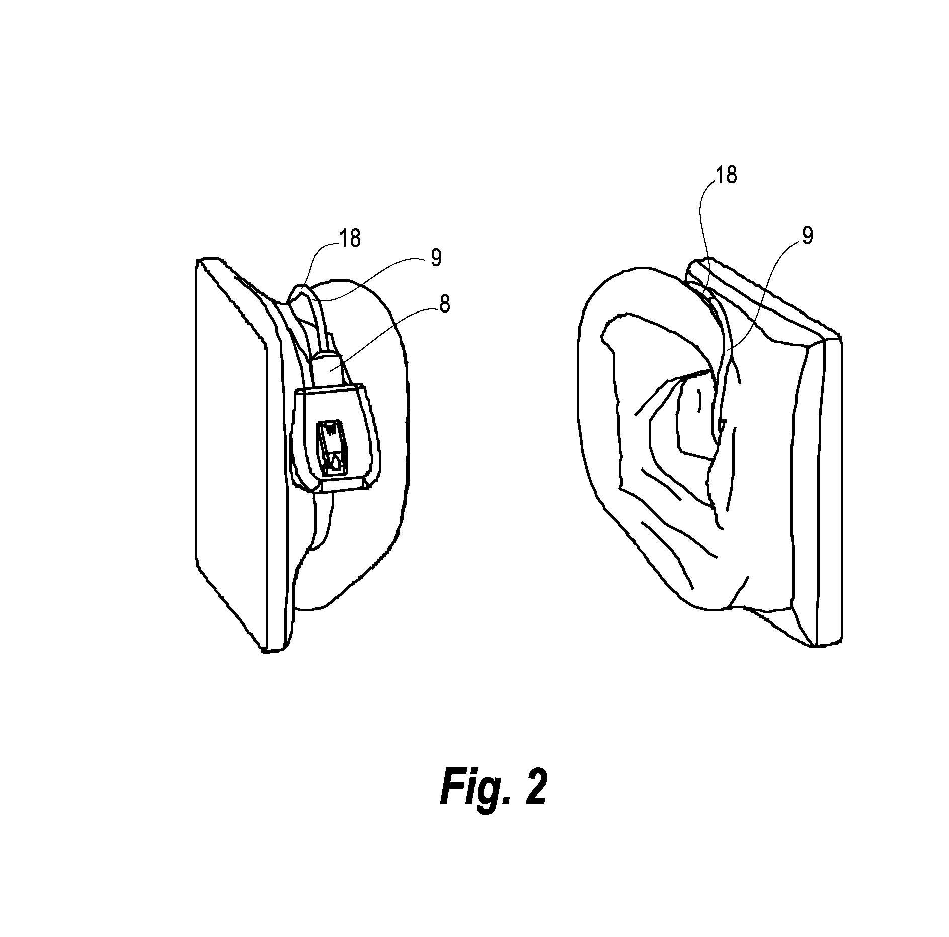 Method of preparing a hearing aid, and a hearing aid