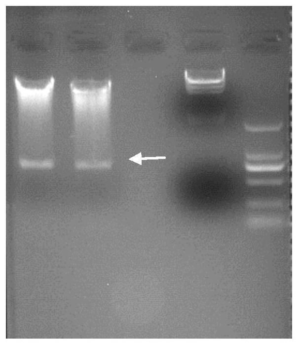 Bifunctional fusion protein combined with coronavirus as well as preparation method and application of bifunctional fusion protein