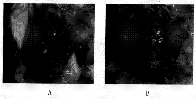 Praziquantel injection and its preparation method and application