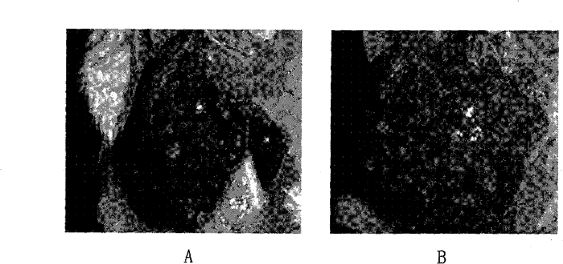 Praziquantel injection and its preparation method and application