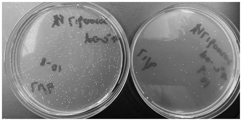 Bacterial strain as well as composition and application
