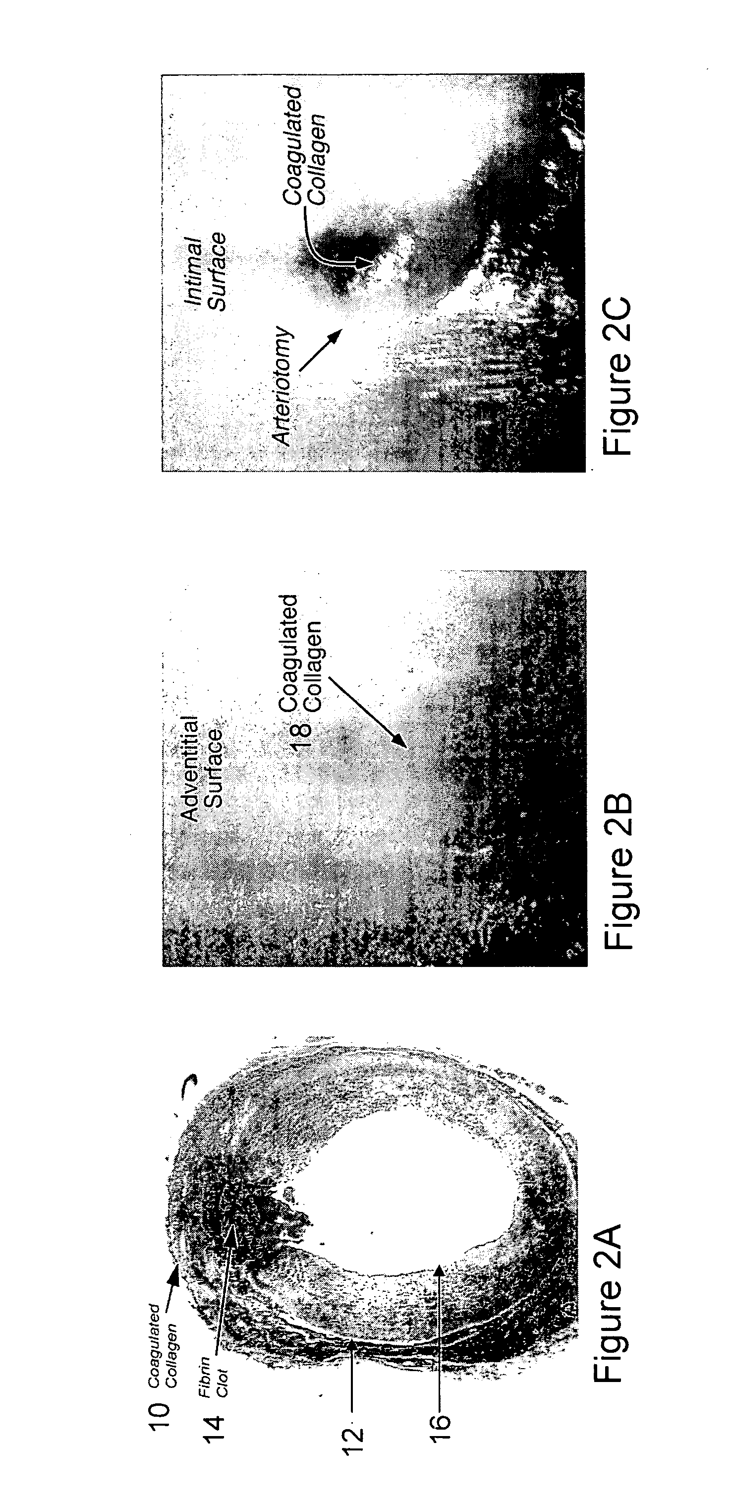 Systems and methods for arteriotomy localization