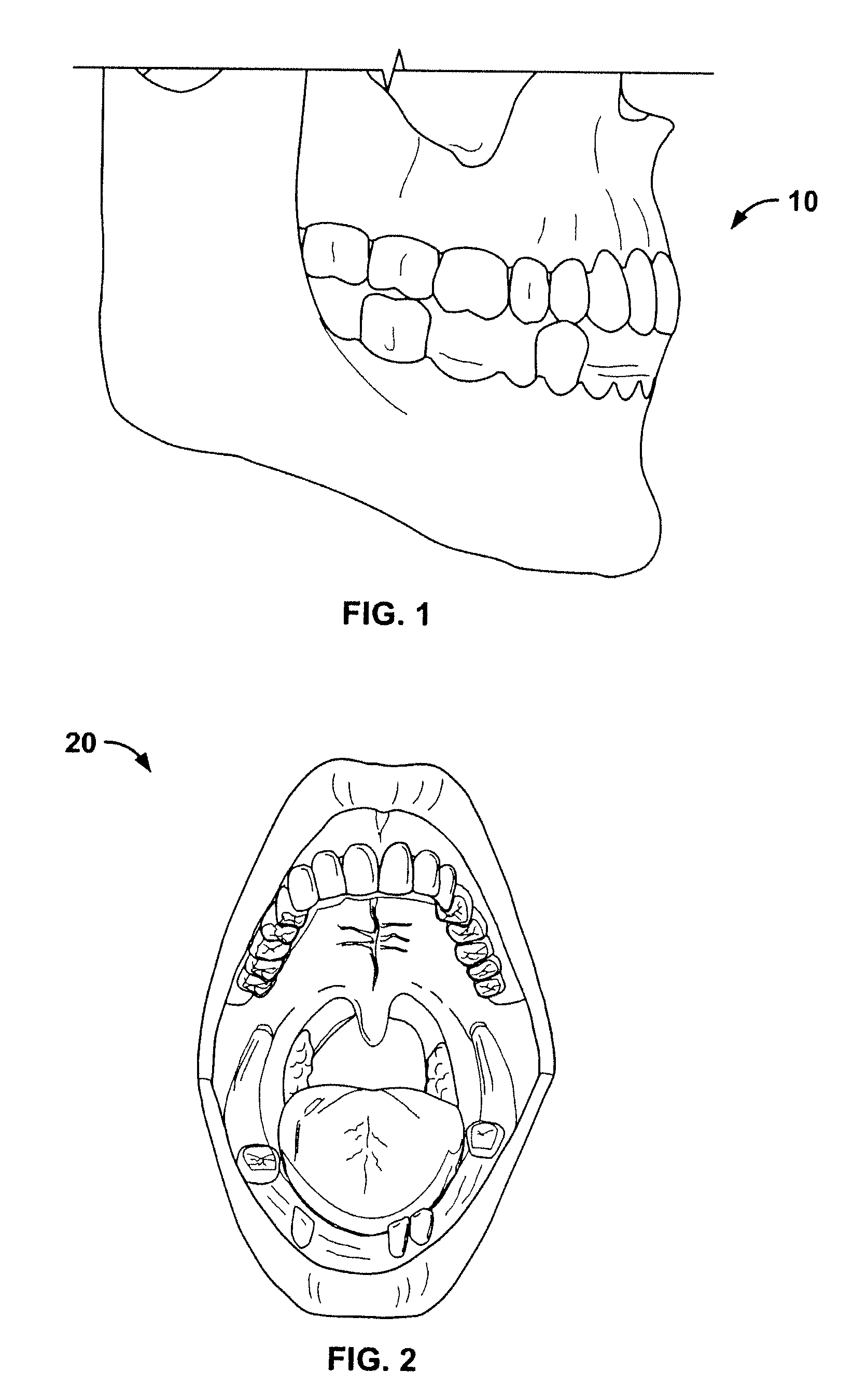 Method for pre-operative visualization of instrumentation used with a surgical guide for dental implant placement