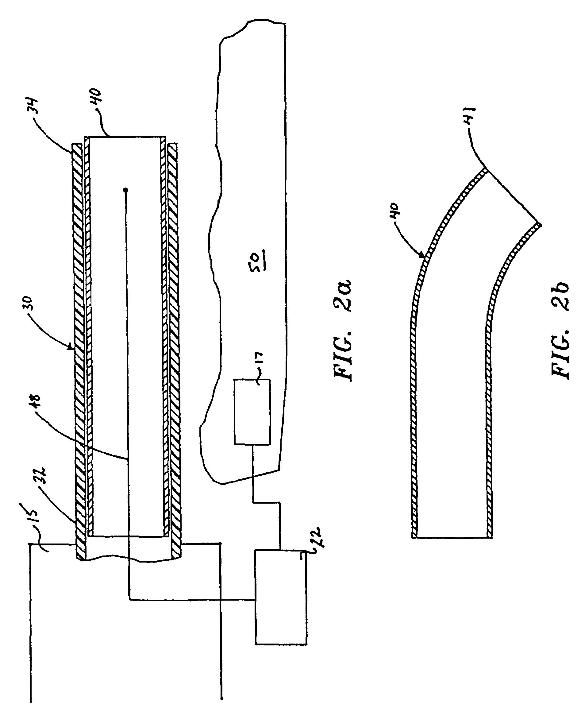 Articulating ionizable gas coagulator