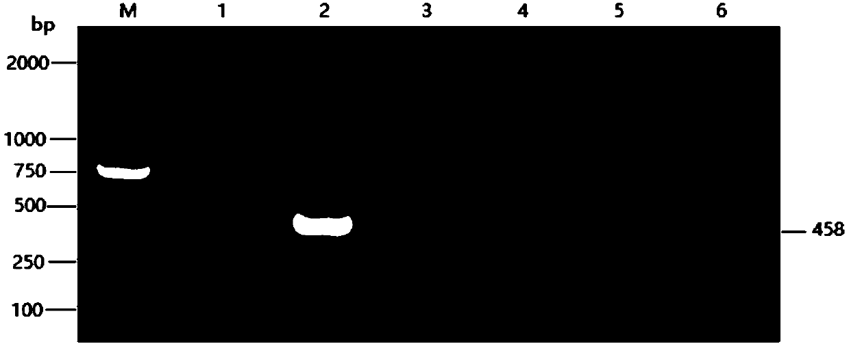 Pigeon chlamydia PCR diagnosis kit and detection method thereof