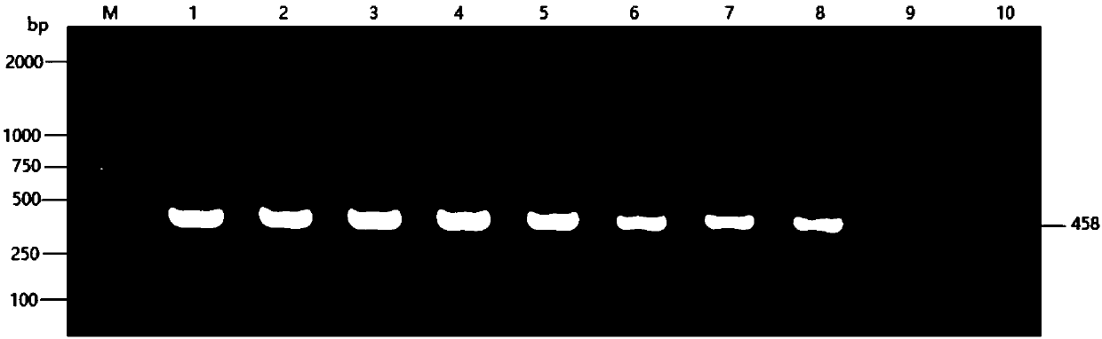 Pigeon chlamydia PCR diagnosis kit and detection method thereof