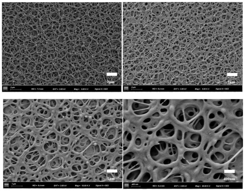 A sulfonated polyetheretherketone-based bone repair composite material