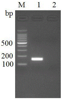 Fluorogenic quantitative PCR detection kit for melissococcus pluton and detection method thereof