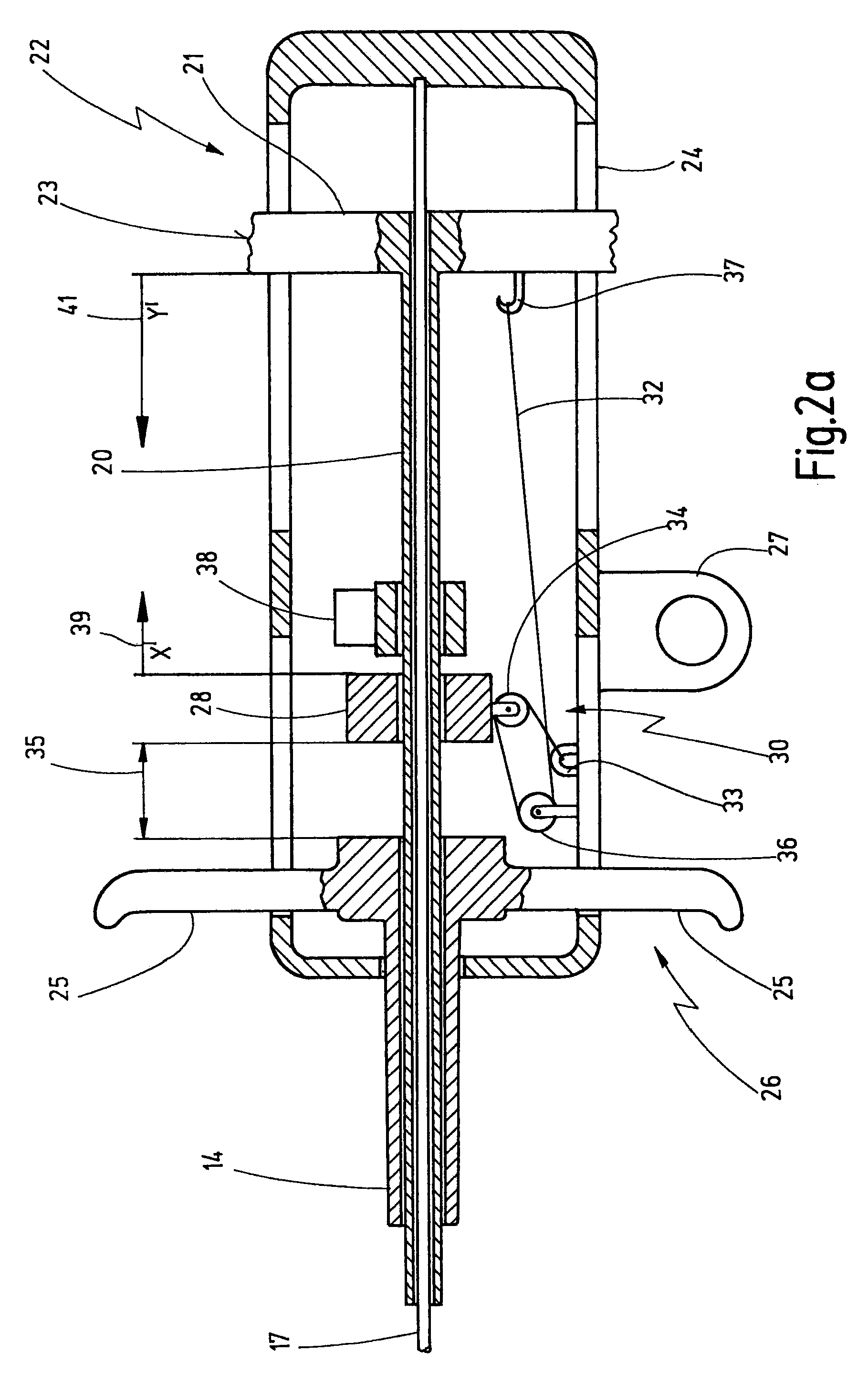 Insertion system for stents, comprising tension-compression kinematics