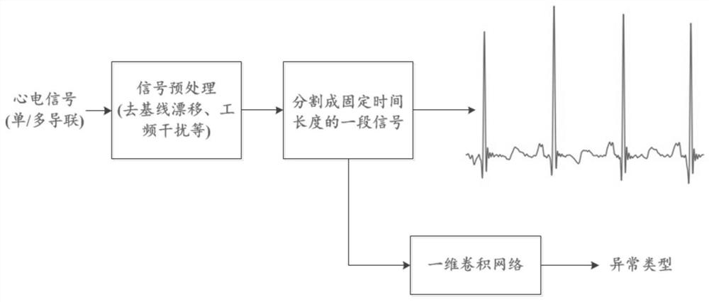 Electrocardiogram analysis method and device based on target detection