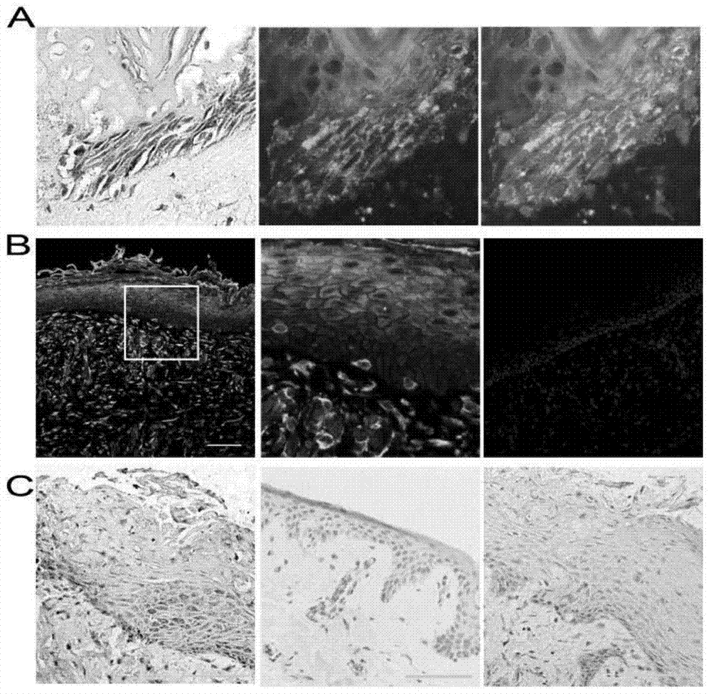 Application of p311 protein in the treatment of skin wounds