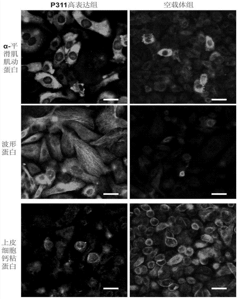 Application of p311 protein in the treatment of skin wounds