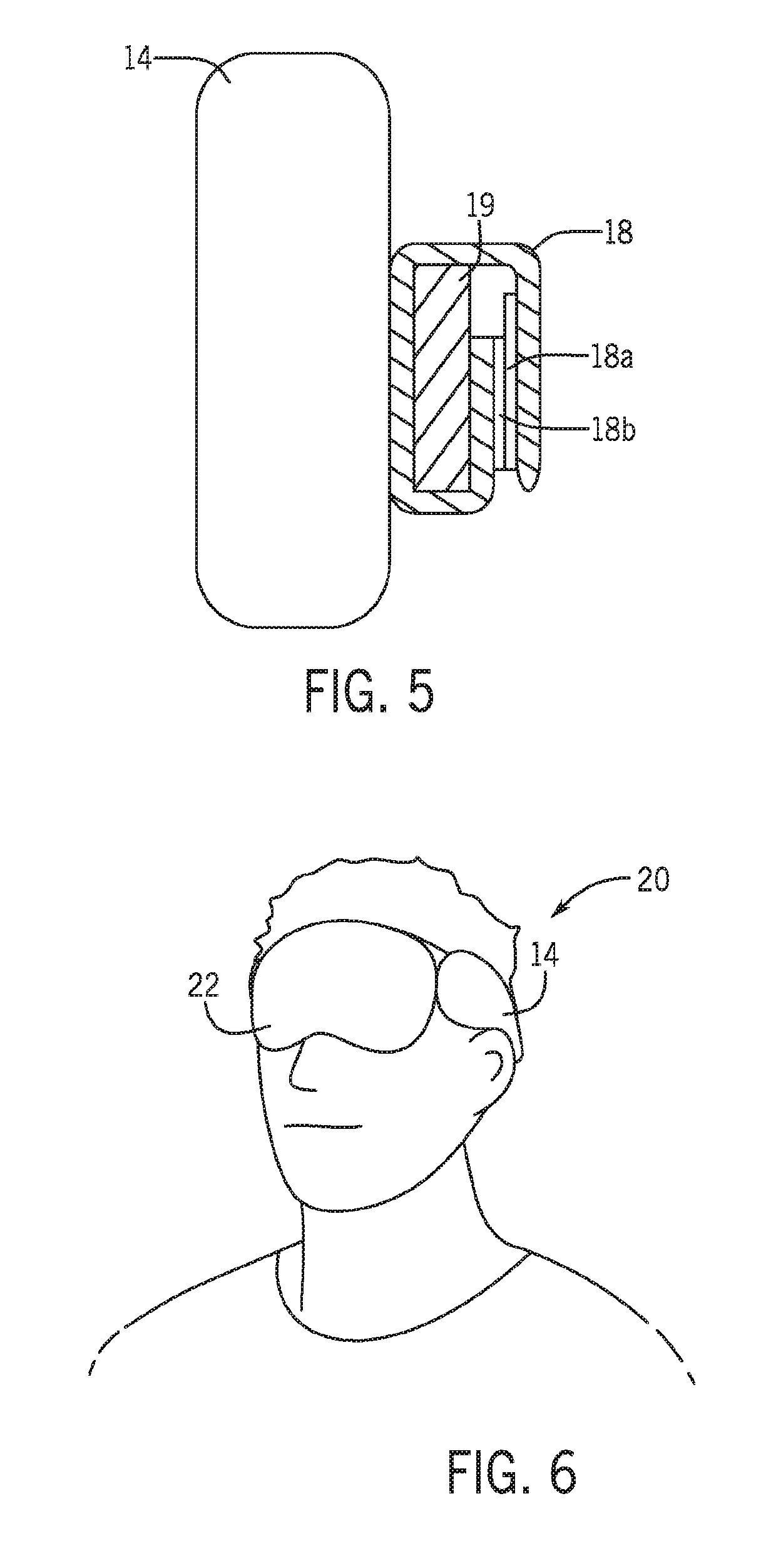 Wrinkle preventing device