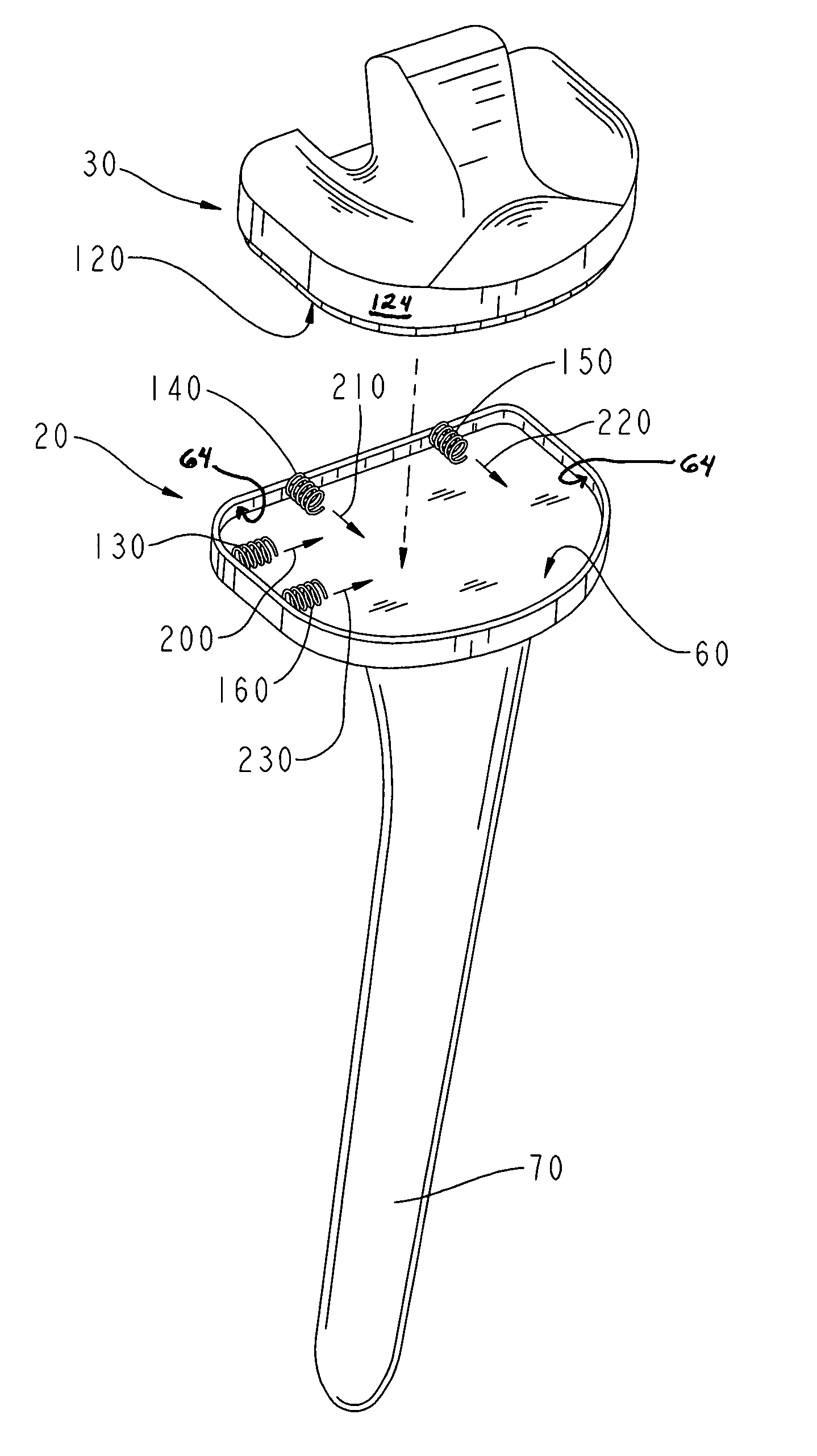 Modular implant with a micro-motion damper