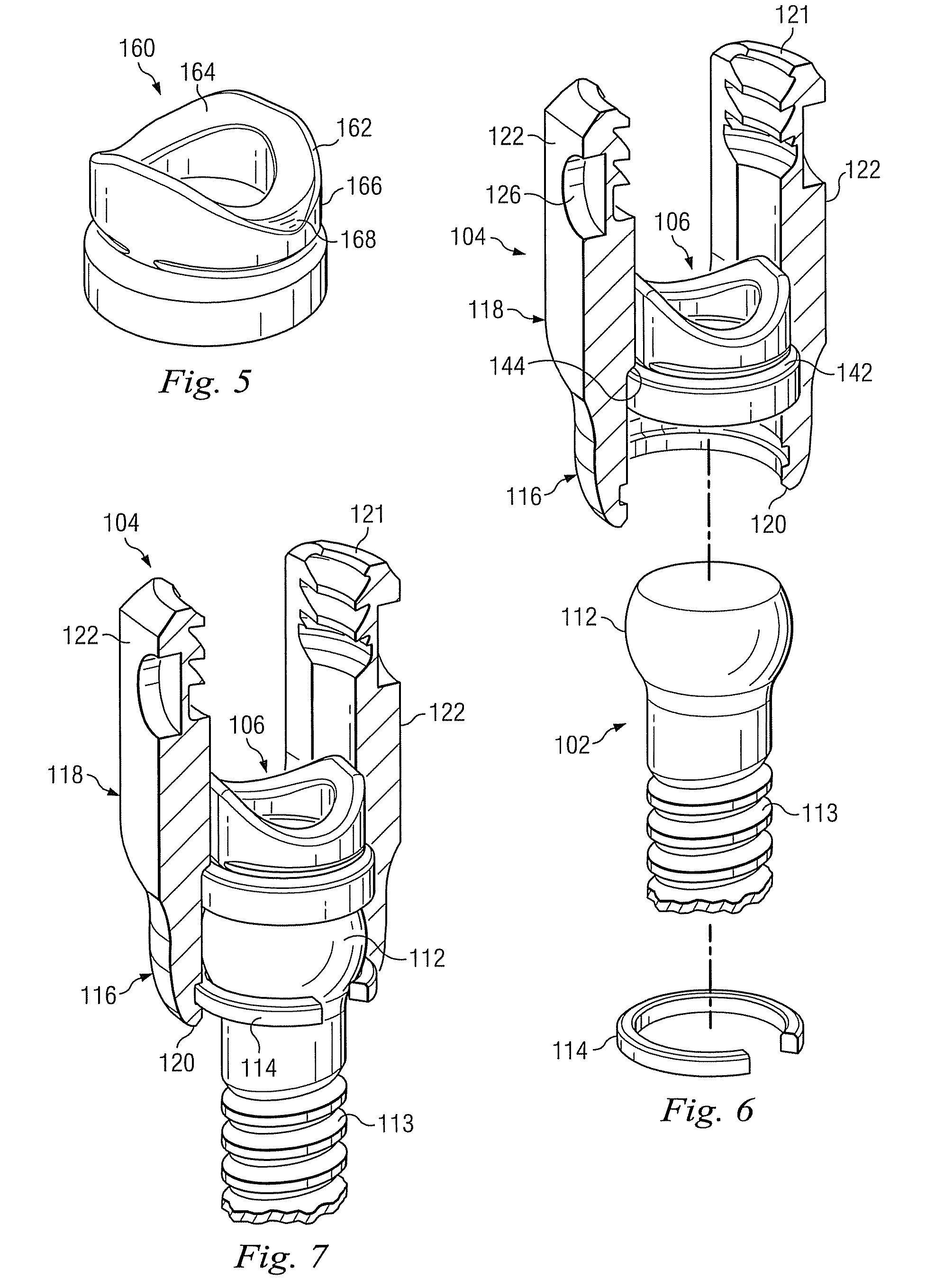 Keyed crown orientation for multi-axial screws