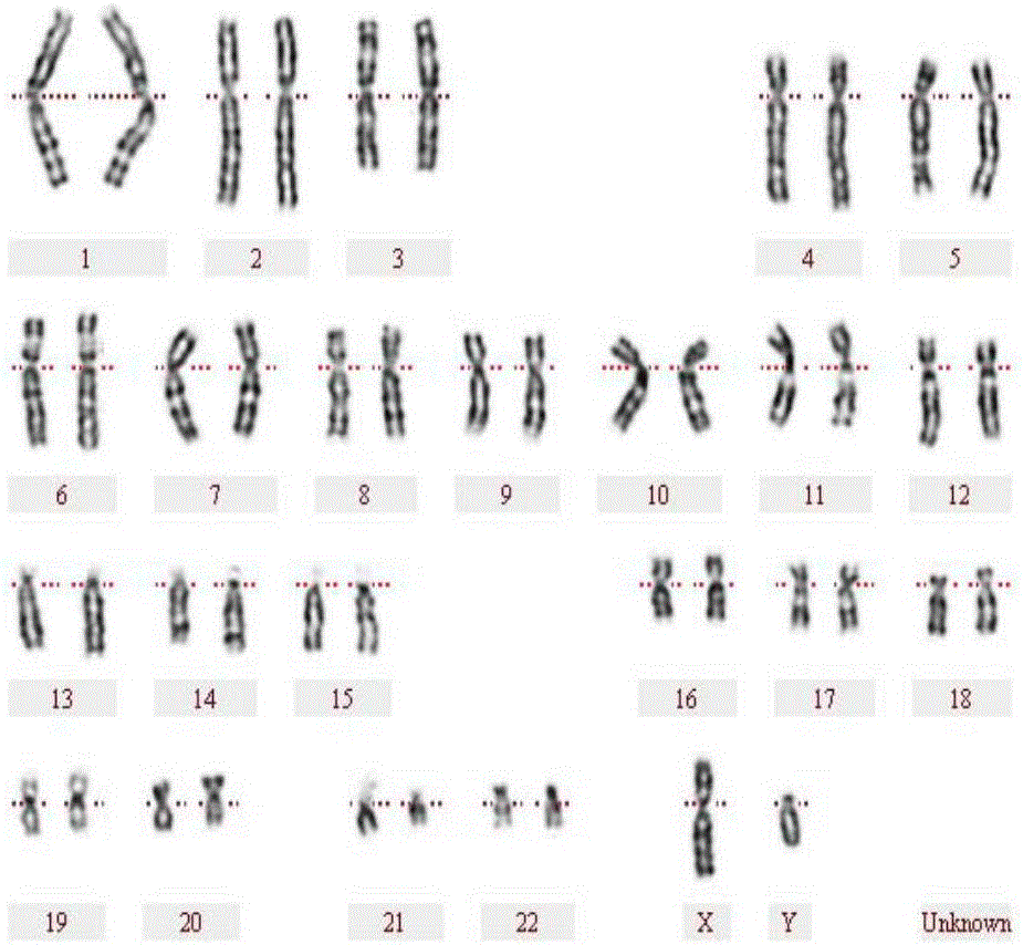 Human peripheral blood chromosome synchronization preparation kit