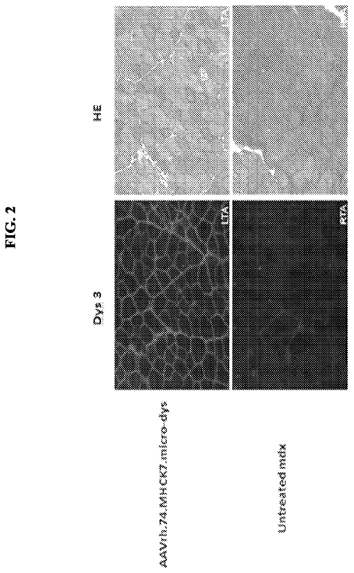 Adeno-associated virus vector delivery of muscle specific micro-dystrophin to treat muscular dystrophy