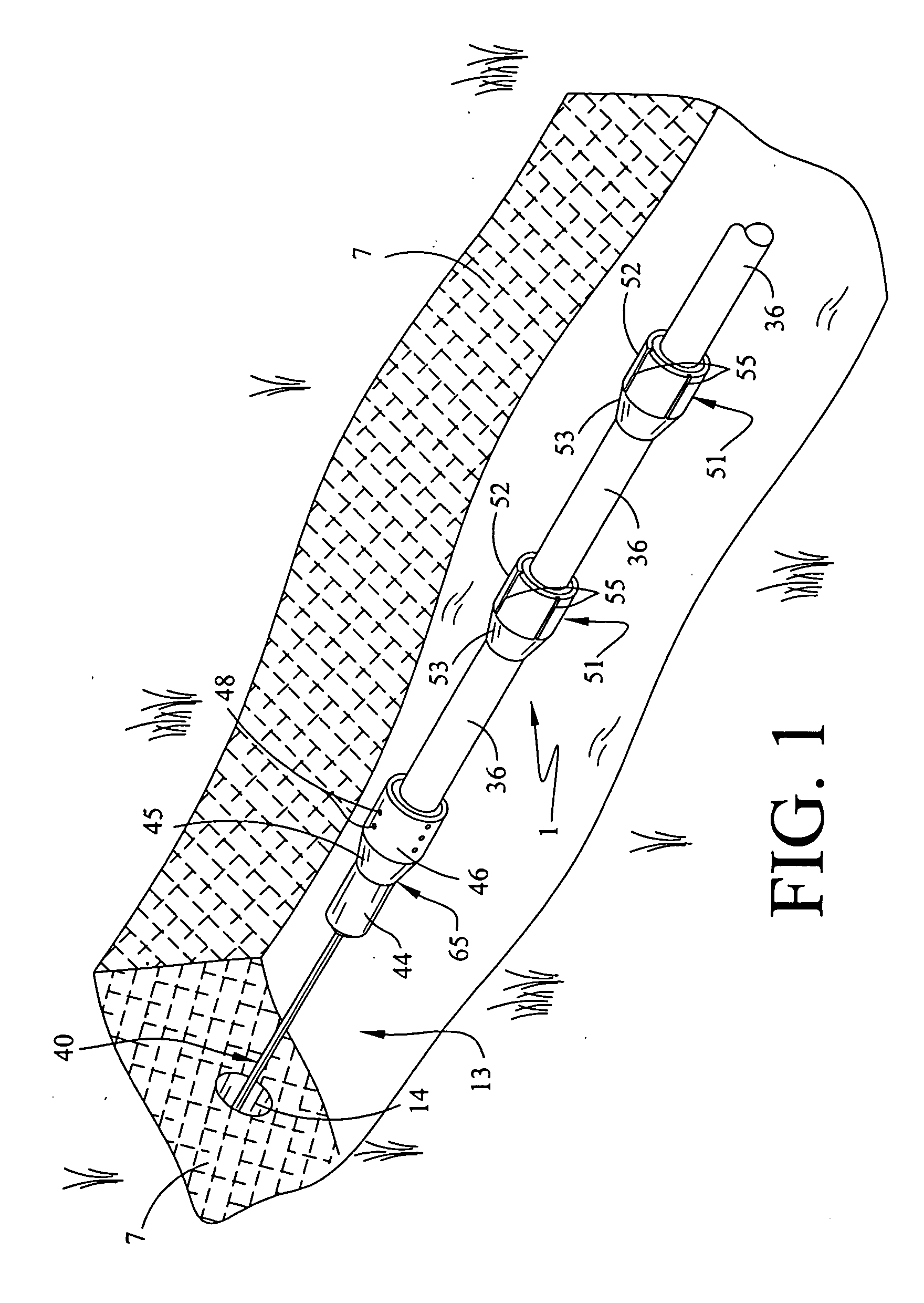 Bore hole sleeve reaming apparatus and method