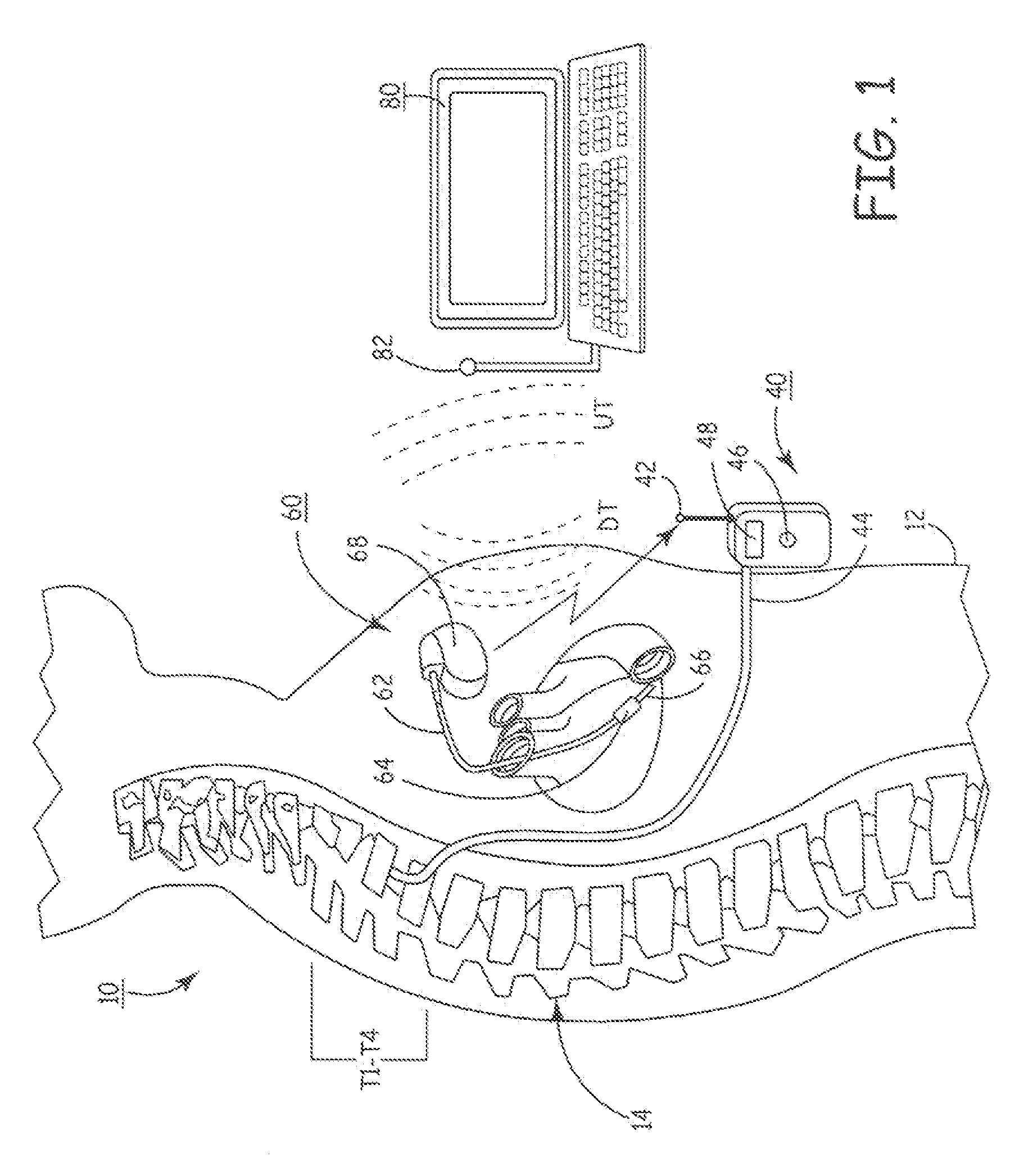 Delivery of a sympatholytic cardiovascular agent to the central nervous system