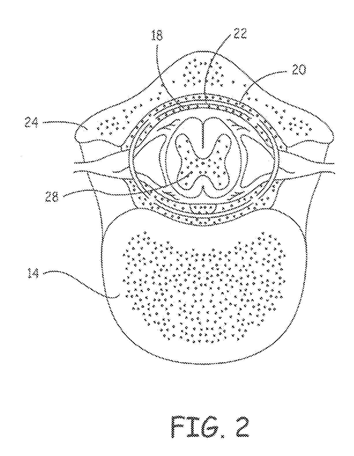 Delivery of a sympatholytic cardiovascular agent to the central nervous system