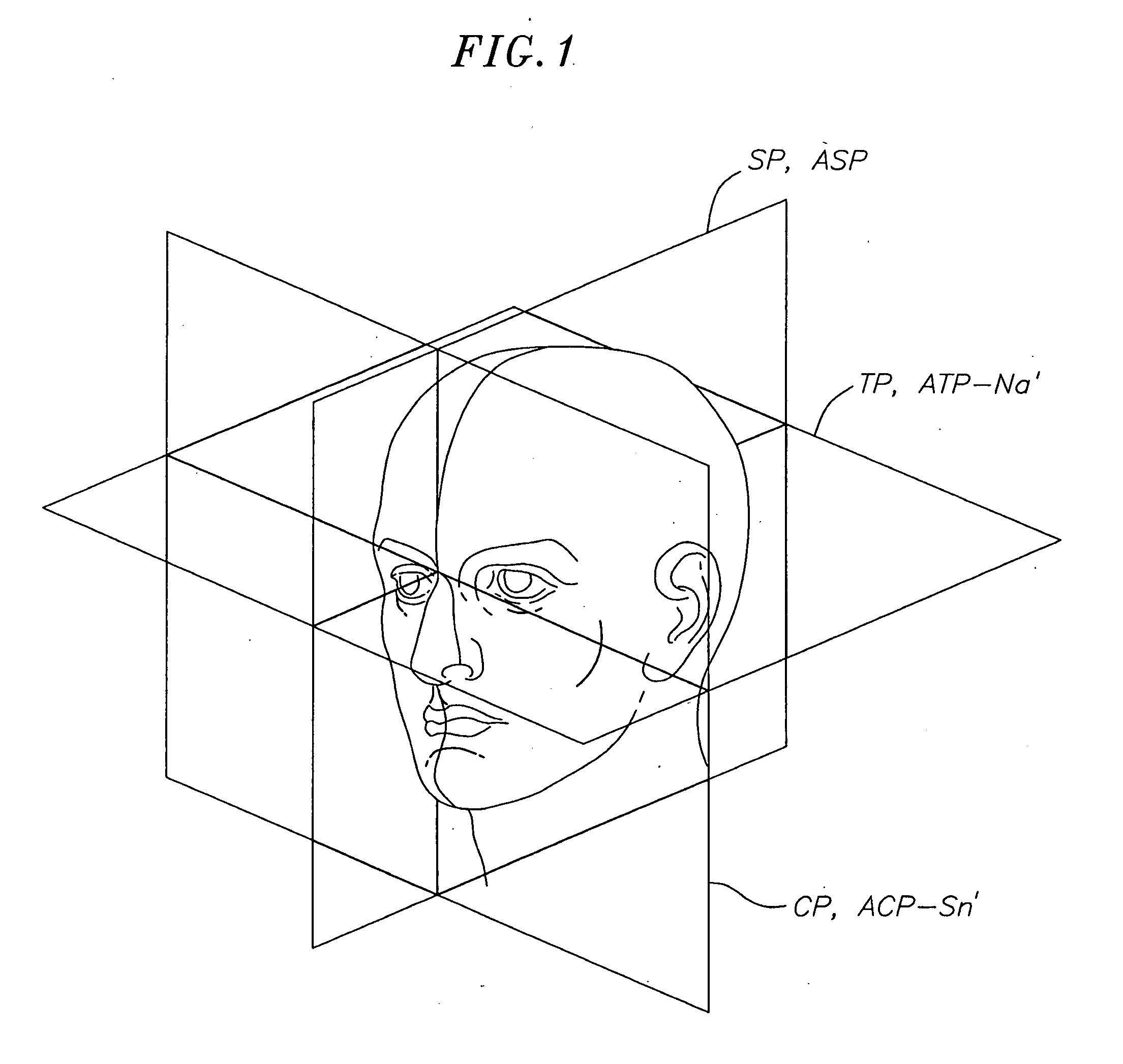 Method for determining the correct natural head position location of references planes relative to a three-dimensional computerized image of a patient's head