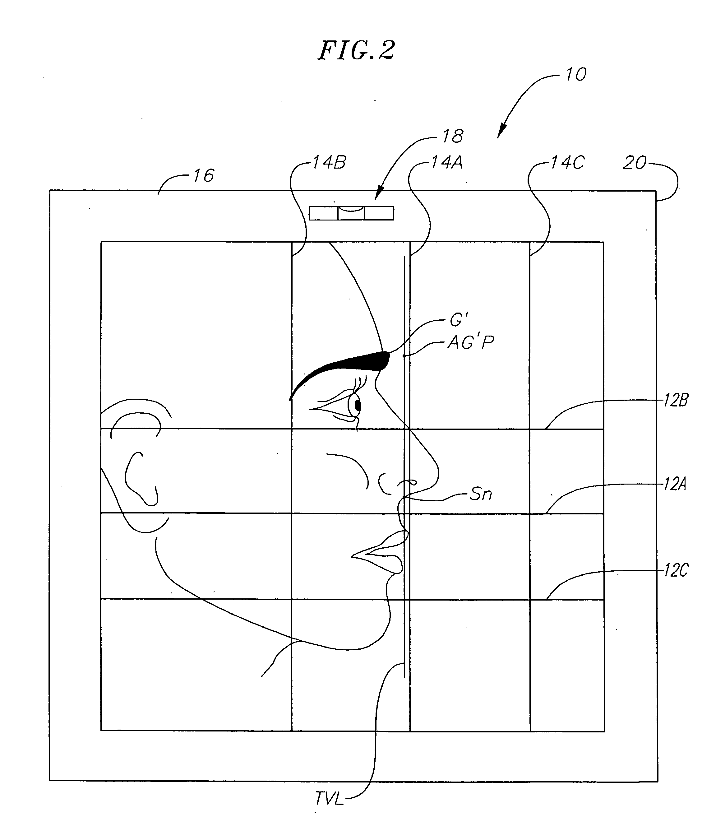 Method for determining the correct natural head position location of references planes relative to a three-dimensional computerized image of a patient's head