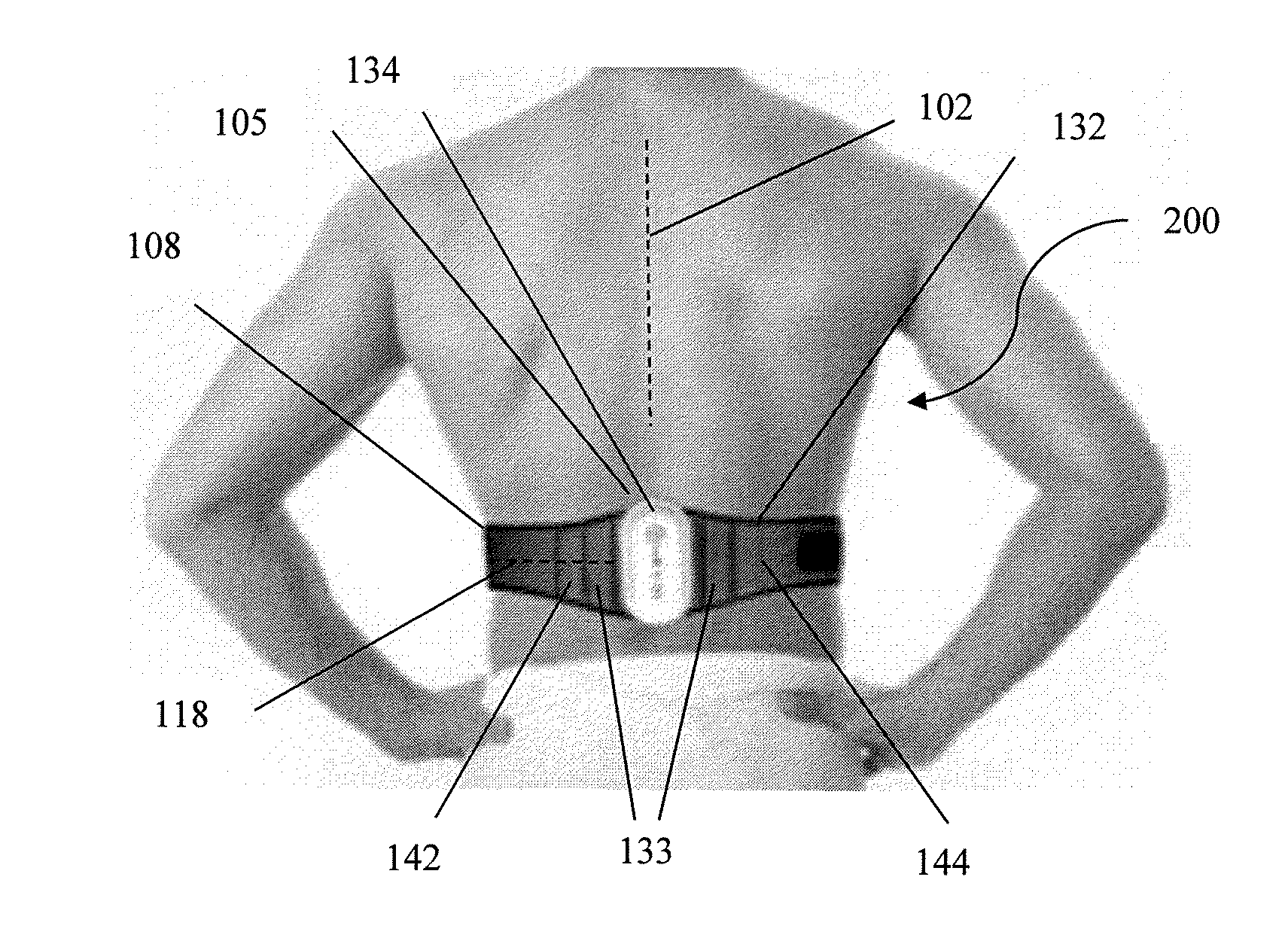 Methods and systems for treatment of spinal disorders using trans-spinal direct current stimulation