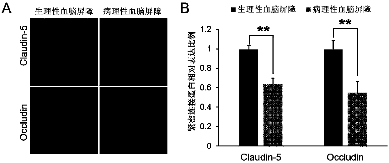 Use of axitinib and analogue thereof in preparation of blood-brain barrier permeability regulating agent