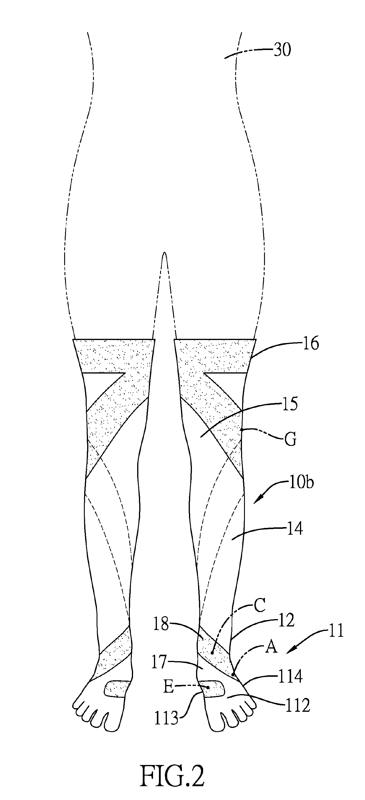 High-arched foot orthosis