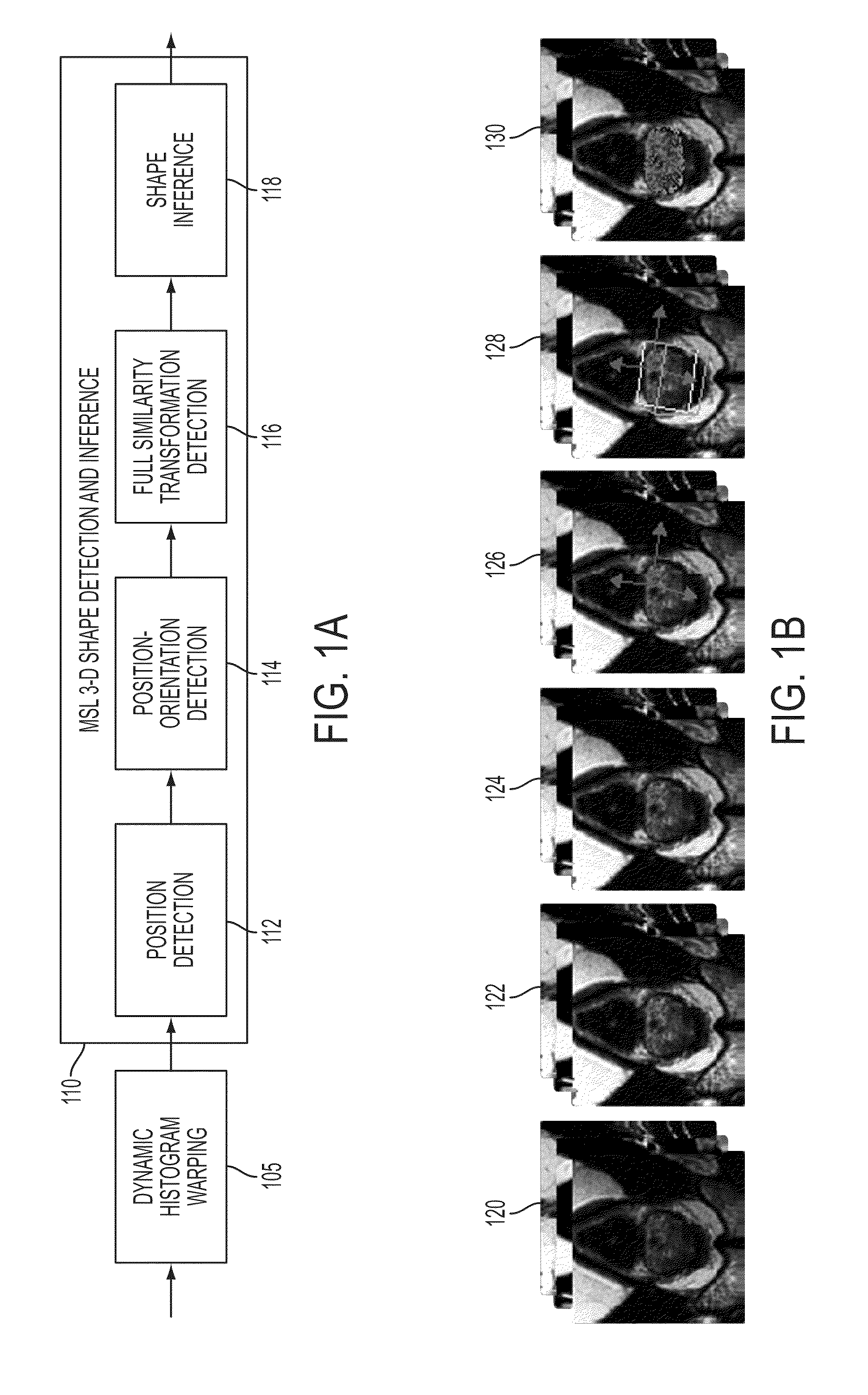 Method and system for segmentation of the prostate in 3D magnetic resonance images