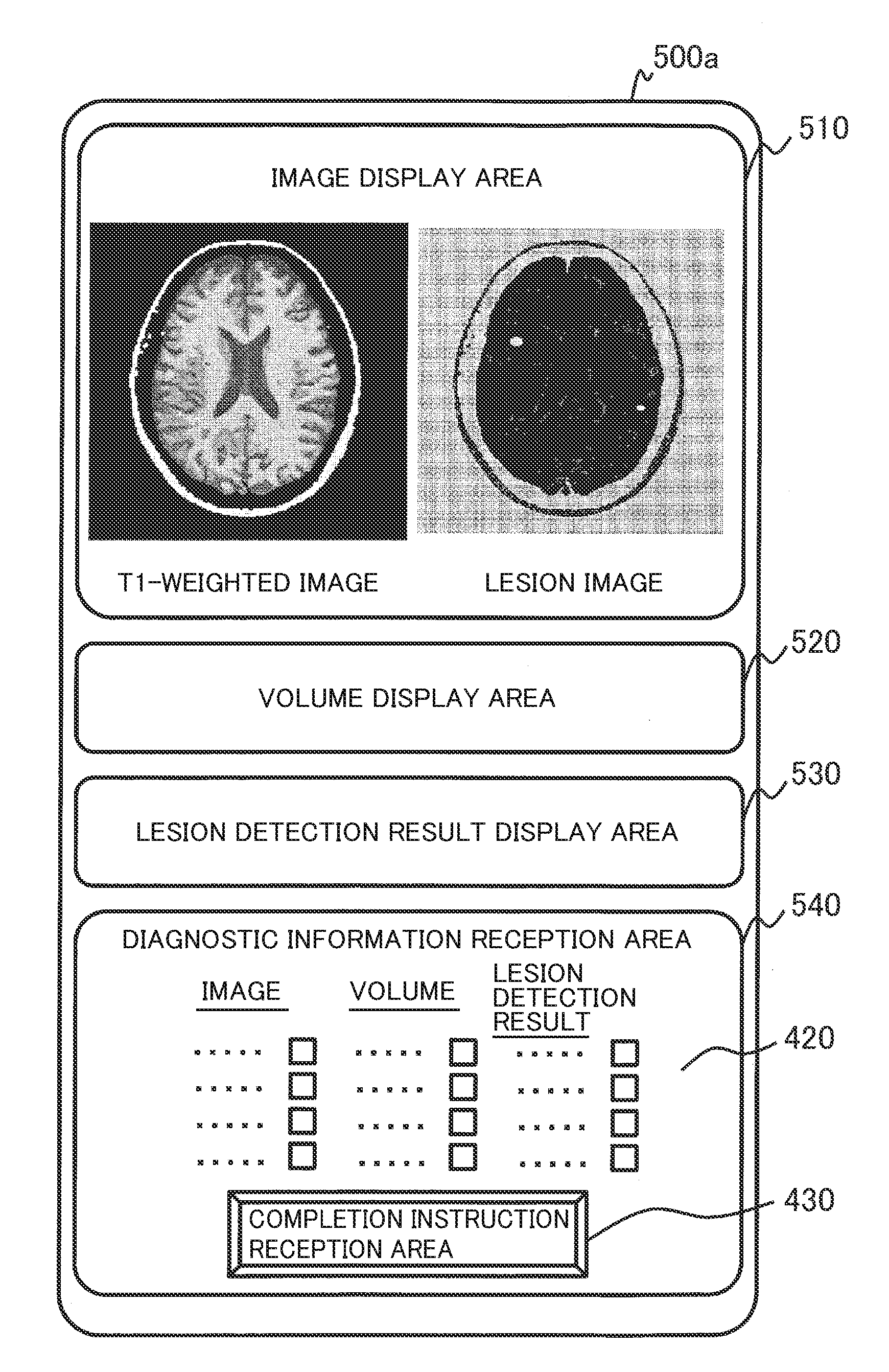 Medical image diagnosis assistance device, magnetic resonance imaging apparatus and medical image diagnosis assistance method