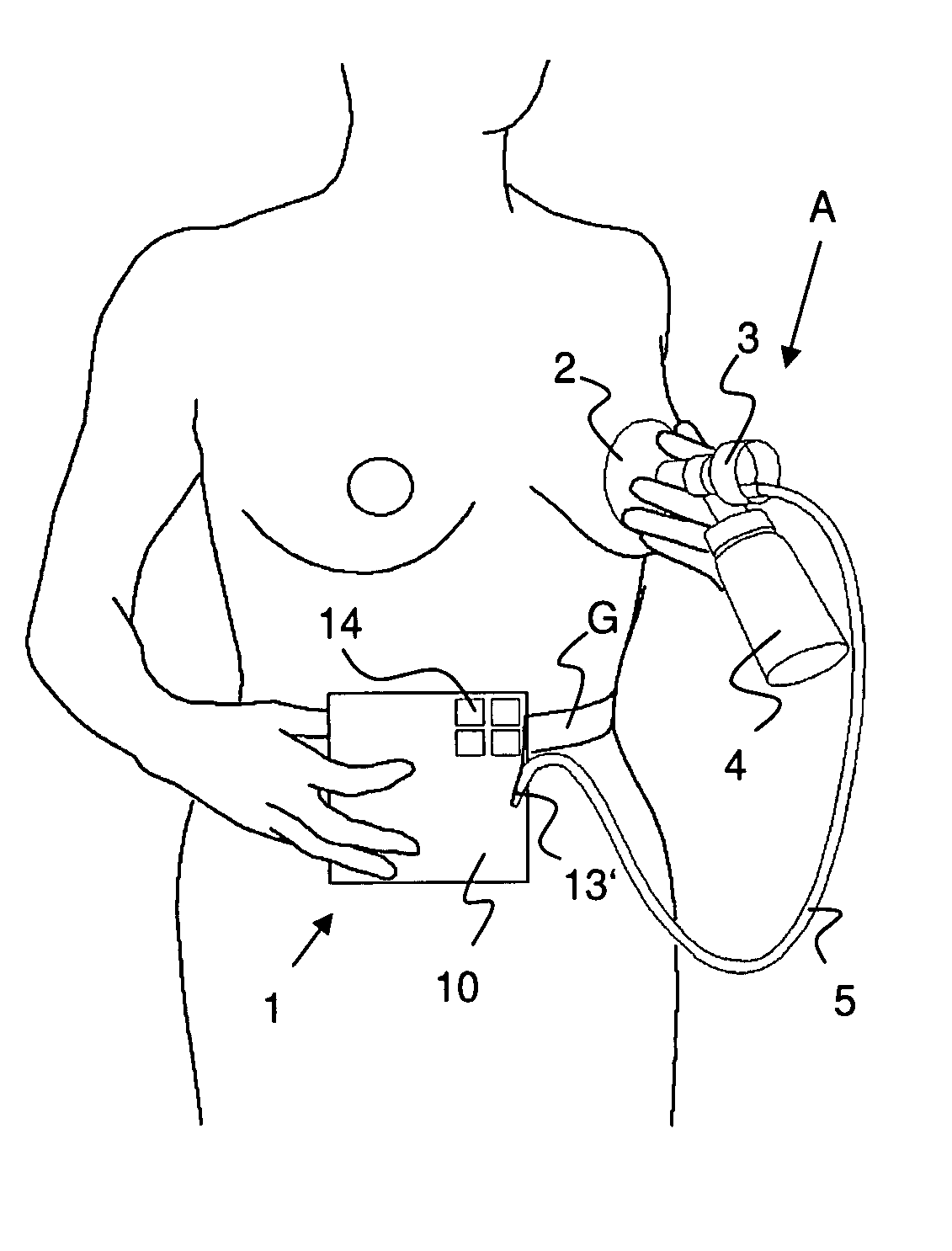 Portable breast pump