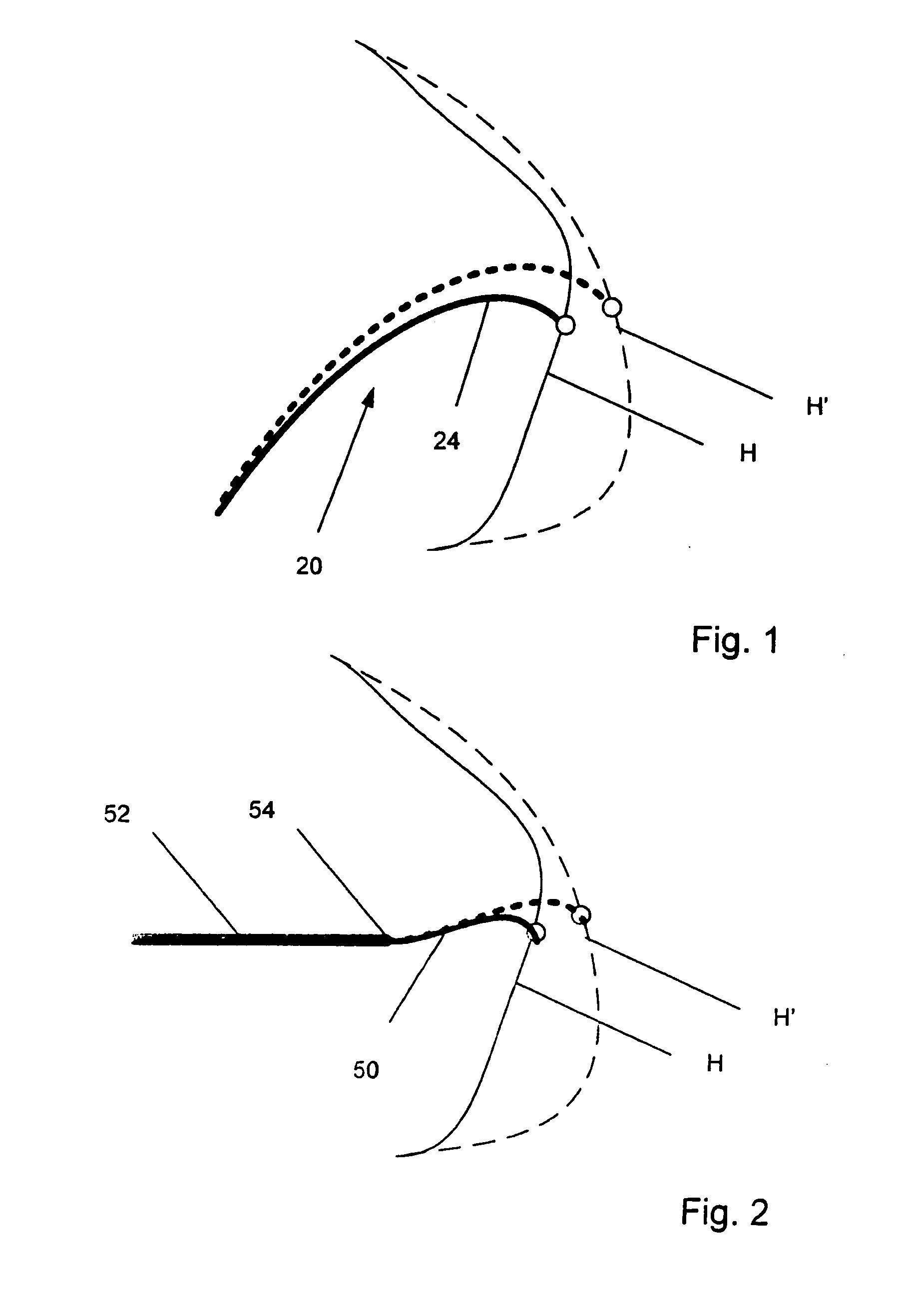 Electrophysiology catheter and system for gentle and firm wall contact