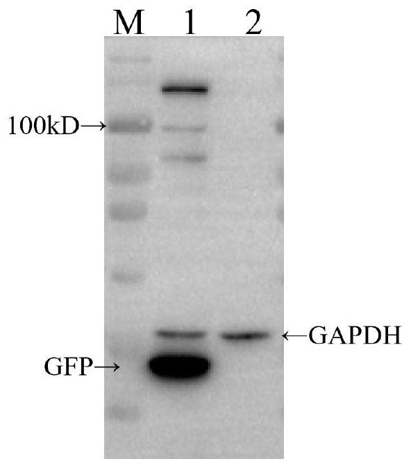 D117L, F317L and EP364R co-expression recombinant adenovirus vector, recombinant adenovirus and construction and application