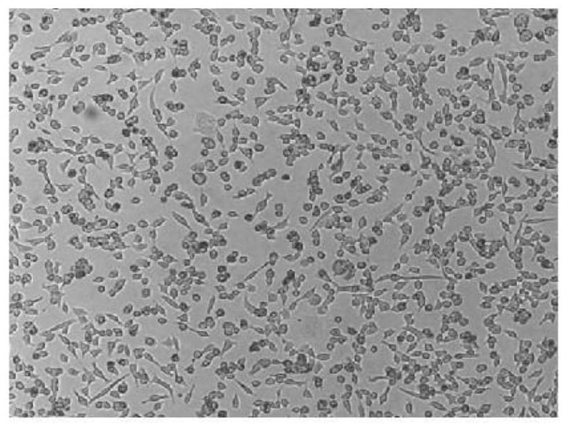 D117L, F317L and EP364R co-expression recombinant adenovirus vector, recombinant adenovirus and construction and application