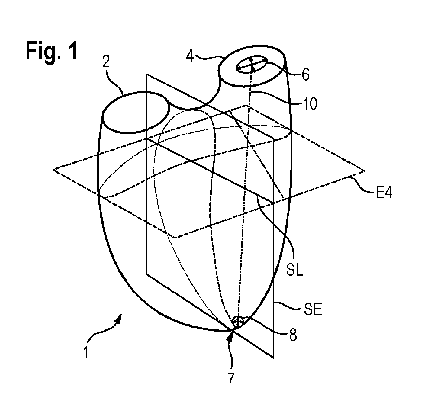 Adaptation of a 3D-surface model to boundaries of an anatomical structure in a 3D-image data set