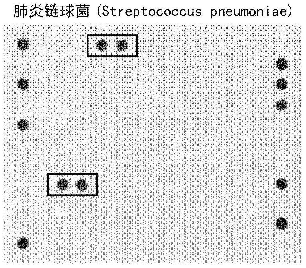 Detection of Streptococcus pneumoniae