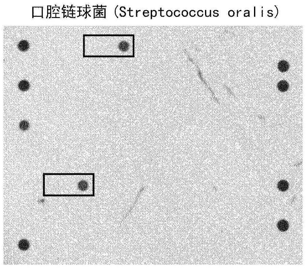 Detection of Streptococcus pneumoniae
