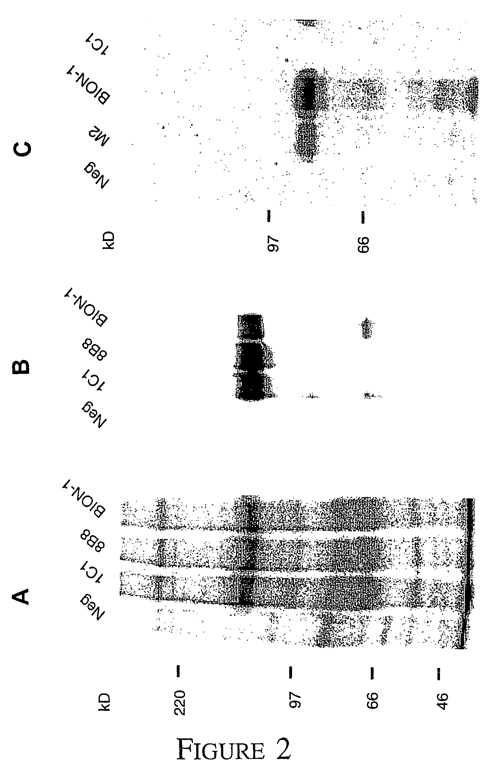 Method of modulating leukemic cell and eosinphil activity with monoclonal antibodies