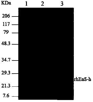 Recombinant human neovascularization inhibin and pharmaceutical composition thereof