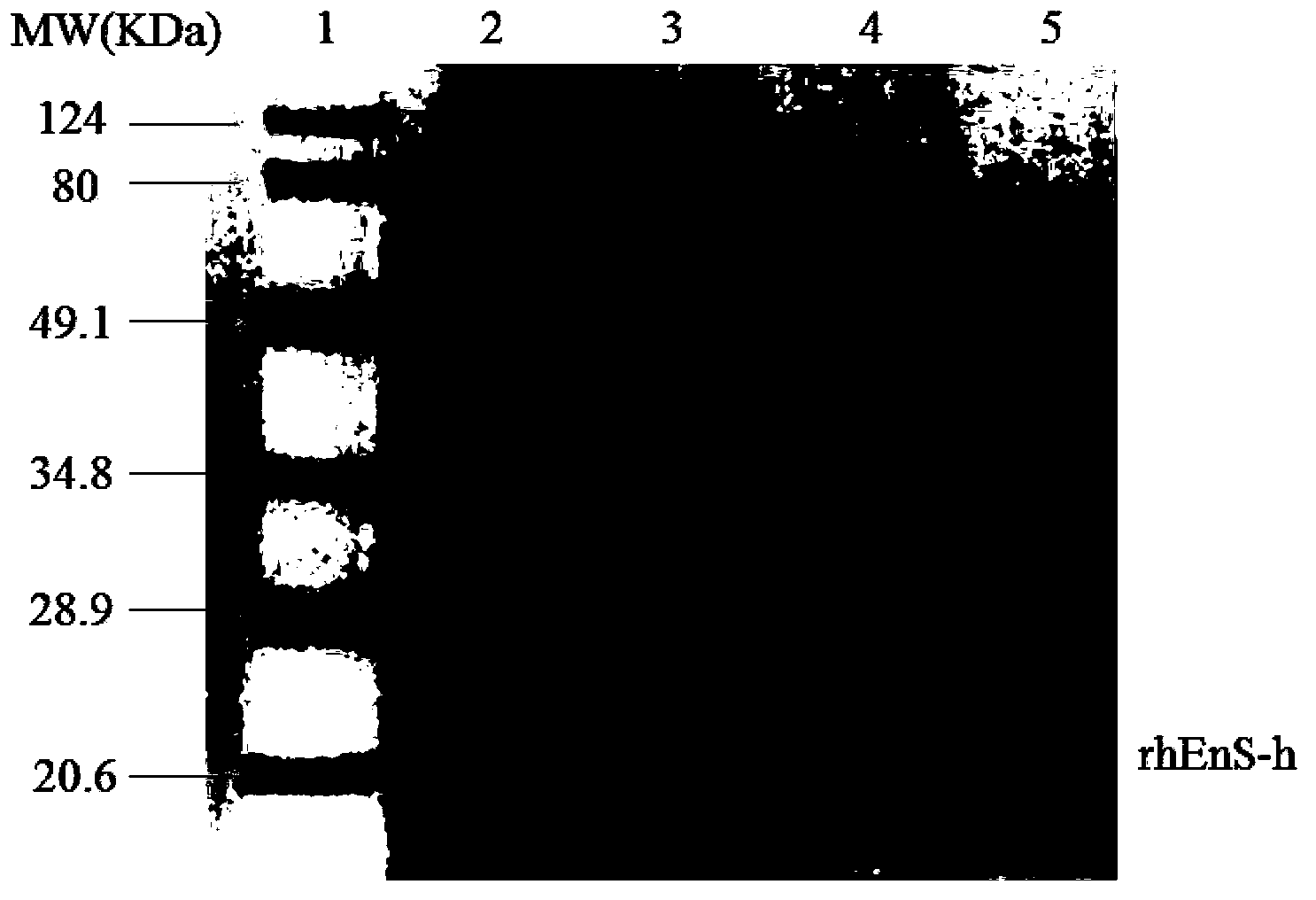 Recombinant human neovascularization inhibin and pharmaceutical composition thereof