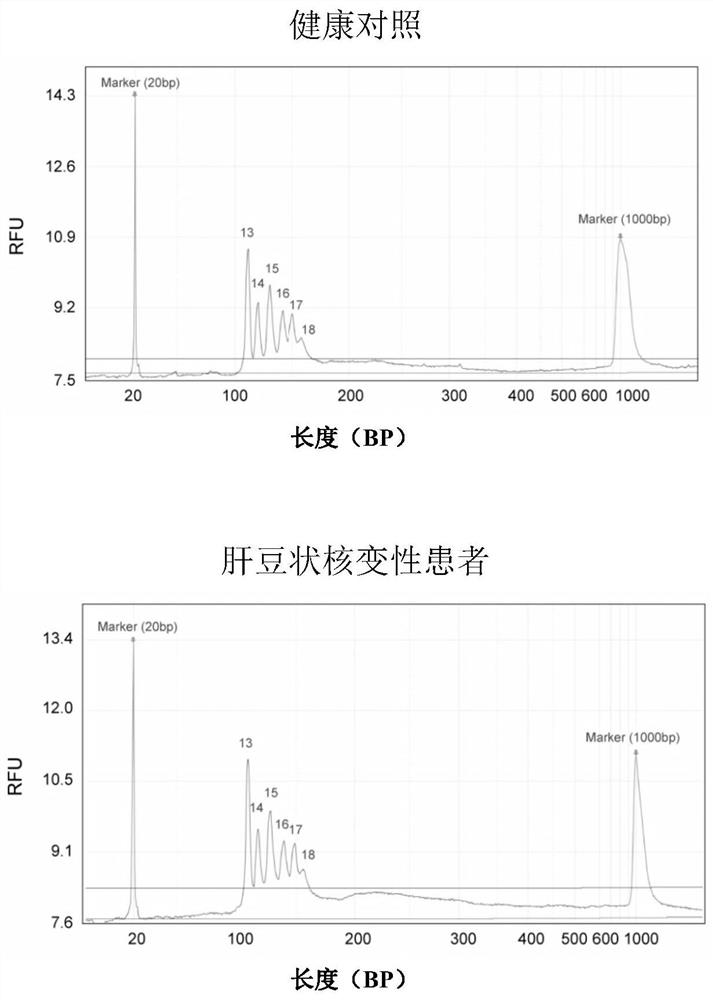 Atp7b Gene Large Fragment Deletion Detection Kit and Detection Method