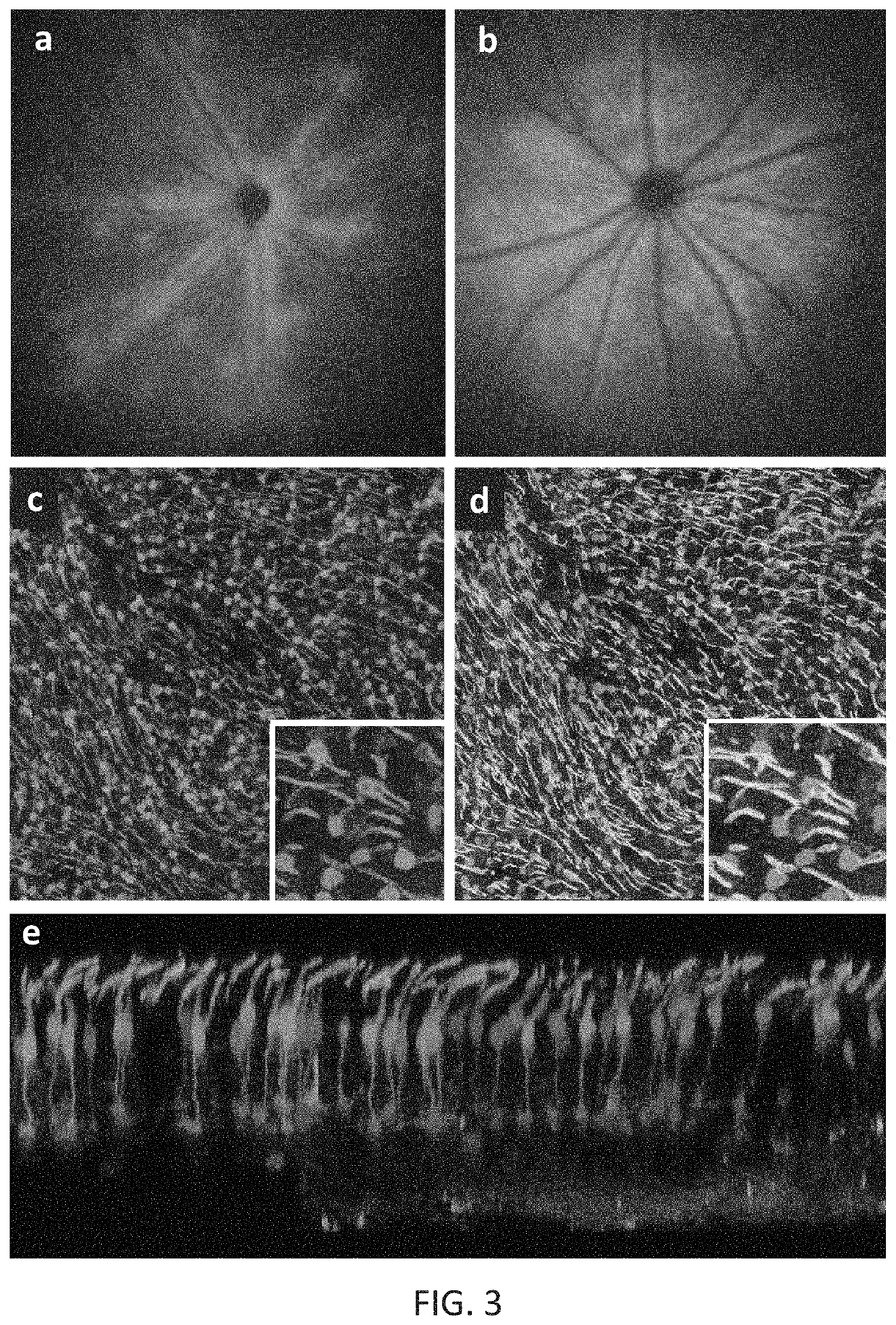 Compositions and methods for intravitreal delivery of polynucleotides to retinal cones